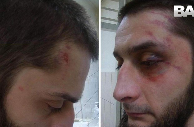 Конвоиры жестоко избили обвиняемого перед заседанием суда в Москве