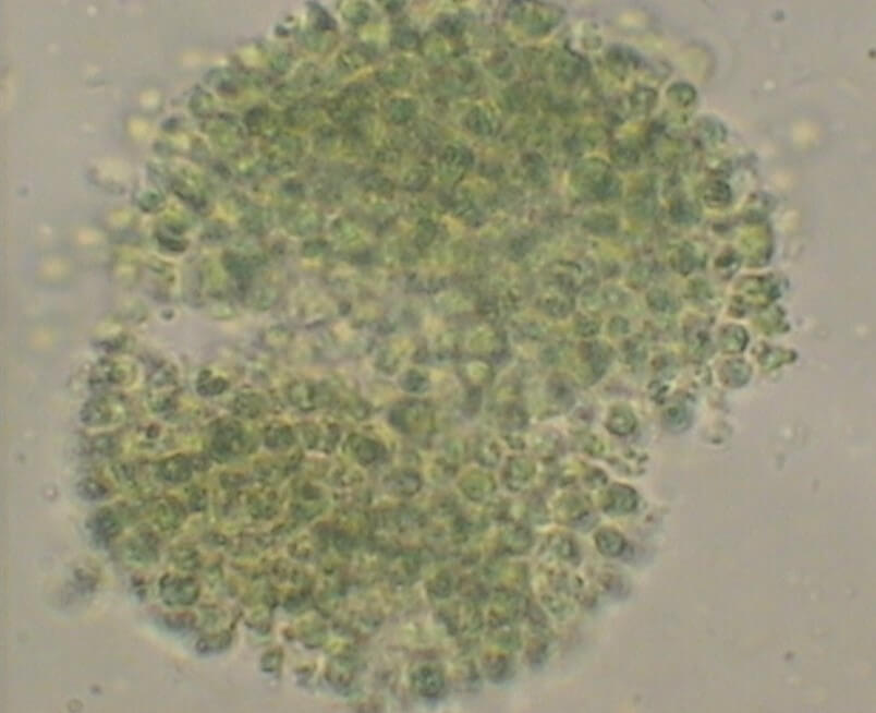 Микроорганизмы, которые использовали для получения…биосорбента (микроскопические водоросли Chlorella). Фото: Пермский Политех